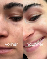Creme Peeling
