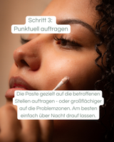 Anti Pickel Paste